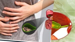 If You Have Gallstones, Never Eat These Foods – Doctor Shares Natural Remedies to Help Break Them Down